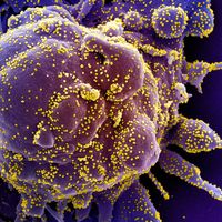 SARS-CoV-2 virus particles