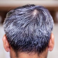Gray hair