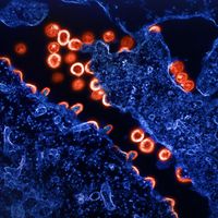 Microscopic image of the AIDS (HIV) virus