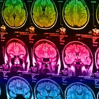 Scans of the human brain