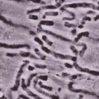 Know how telomeres protect the ends of the chromosomes and over a while, it causes cellular aging